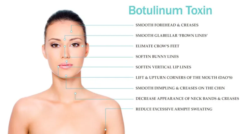 Menurunkan Berat Badan Anti Kerutan Beutox Batulaxs Resty Filler Dermal Juvederms 0